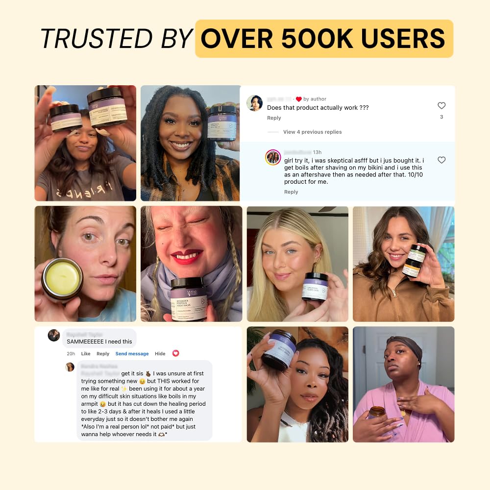 MyMagicHealer Universal Flare Care – Multi-Purpose Solution | Skin Flare-Ups - Hidradenitis Suppurativa, Folliculitis, Boils, Cysts | Anti-Chafing | Irritated Skin Relief w/Propolis & Egg Yolk 4 oz