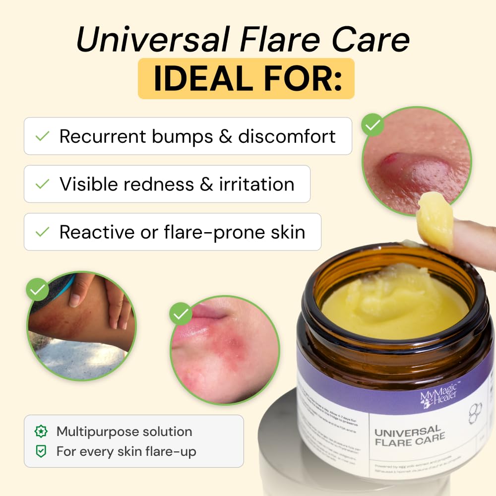 MyMagicHealer Universal Flare Care – Multi-Purpose Solution | Skin Flare-Ups - Hidradenitis Suppurativa, Folliculitis, Boils, Cysts | Anti-Chafing | Irritated Skin Relief w/Propolis & Egg Yolk 4 oz